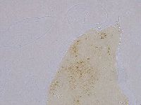 Ramazzottius oberhaeuseri image