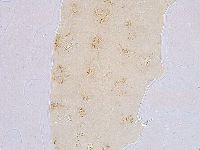 Ramazzottius oberhaeuseri image