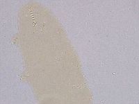 Ramazzottius oberhaeuseri image