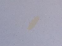 Ramazzottius oberhaeuseri image