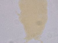 Ramazzottius oberhaeuseri image