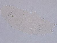 Ramazzottius oberhaeuseri image
