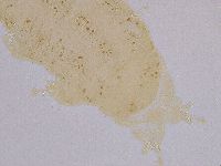 Ramazzottius oberhaeuseri image