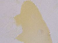 Ramazzottius oberhaeuseri image