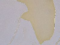 Ramazzottius oberhaeuseri image