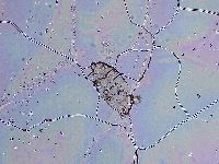 Ramazzottius oberhaeuseri image