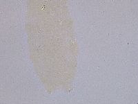 Ramazzottius oberhaeuseri image