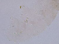 Ramazzottius oberhaeuseri image