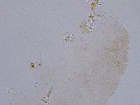Ramazzottius oberhaeuseri image