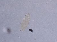 Ramazzottius oberhaeuseri image