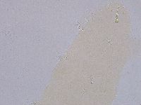 Ramazzottius oberhaeuseri image