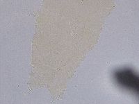 Ramazzottius oberhaeuseri image