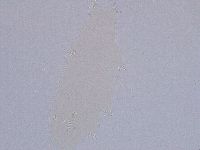 Ramazzottius oberhaeuseri image