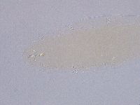 Ramazzottius oberhaeuseri image