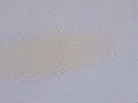Ramazzottius oberhaeuseri image