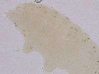 Ramazzottius oberhaeuseri image