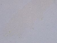 Ramazzottius oberhaeuseri image