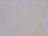 Ramazzottius oberhaeuseri image