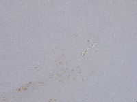 Ramazzottius oberhaeuseri image