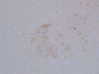 Ramazzottius oberhaeuseri image