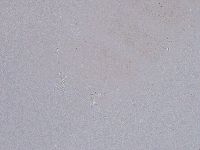 Ramazzottius oberhaeuseri image