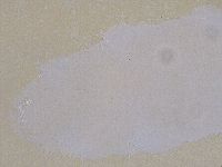Ramazzottius oberhaeuseri image