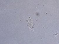 Ramazzottius oberhaeuseri image