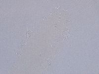 Ramazzottius oberhaeuseri image