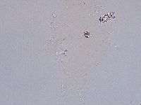 Ramazzottius oberhaeuseri image