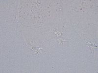 Ramazzottius oberhaeuseri image