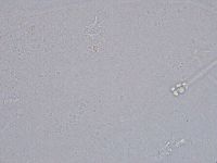 Ramazzottius oberhaeuseri image