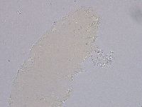 Ramazzottius oberhaeuseri image