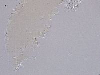 Ramazzottius oberhaeuseri image