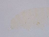 Ramazzottius oberhaeuseri image