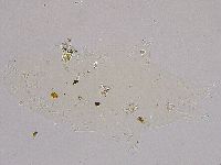 Ramazzottius oberhaeuseri image
