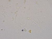 Ramazzottius oberhaeuseri image