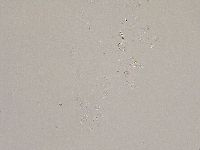 Ramazzottius oberhaeuseri image