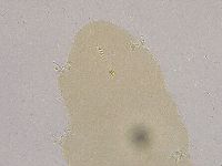 Ramazzottius oberhaeuseri image