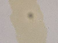 Ramazzottius oberhaeuseri image
