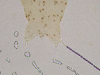 Ramazzottius oberhaeuseri image