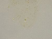 Ramazzottius oberhaeuseri image