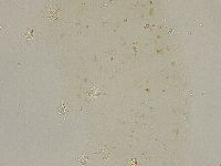Ramazzottius oberhaeuseri image