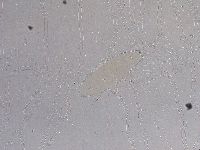 Ramazzottius oberhaeuseri image