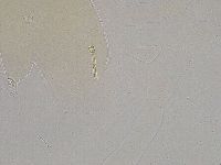 Ramazzottius oberhaeuseri image