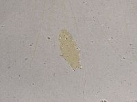 Ramazzottius oberhaeuseri image