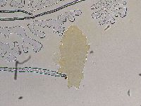 Ramazzottius oberhaeuseri image