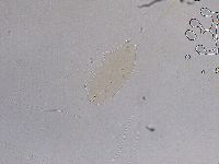 Ramazzottius oberhaeuseri image