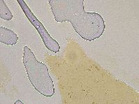 Ramazzottius oberhaeuseri image
