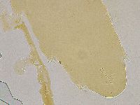 Ramazzottius oberhaeuseri image