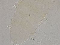Ramazzottius oberhaeuseri image